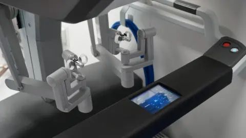 Shaun Whitmore/BBC A surgeon's eye view of the console that he sits at when performing robotic surgery. There is a black ledge across his lap with a number of monitoring devices on a digital display. You can see whilte finger holes where the surgeon places his fingers to make virtual movements. These move on two independent arms.