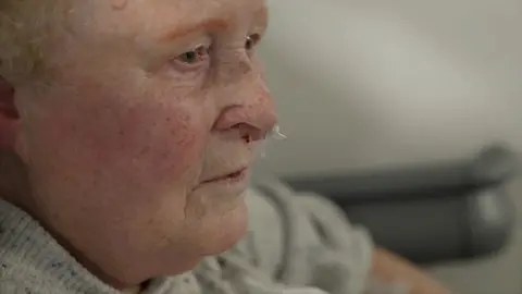 86 -year -old Kathleen Hill, waiting in a corridor for seven hours with a bloody nose