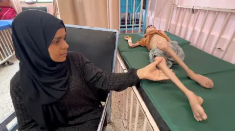 A mother sits by the side of a hospital bed with her emaciated child