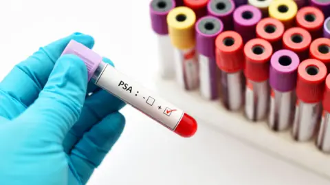 Getty Images Gloved hand holding a test tube labelled PSA, for prostate-specific antigen