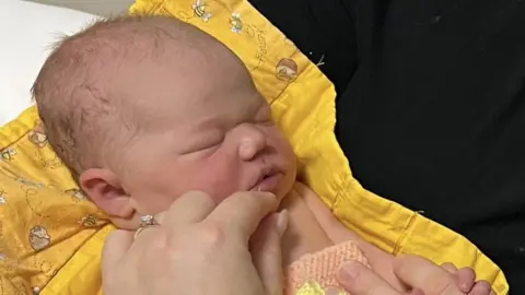Family handout Baby, Emmy Russo after being born by caesarian section at the Princess Alexandra Hospital in Harlow. She is newborn in the picture and has her eyes closed, she is laying on a yellow sheet and her mother is stroking her chin. She is wrapped in a wool, homemade blanket.