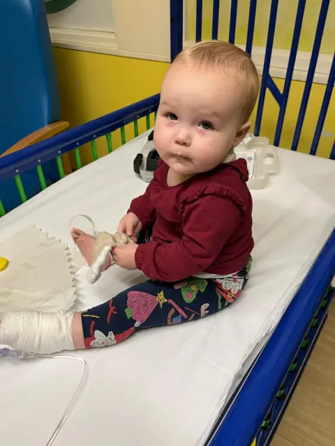 Family handout. A one year old girl is sitting in a hospital cot looking unhappy. She has a bandage on one foot and tubes coming out of a dressing on her other foot. She is wearing a burgundy top and patterned leggings. 