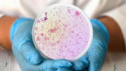 Getty Images A man wearing blue medical gloves holds a circular frame from a microscope containing Neisseria gonorrhoea, the bacteria that causes gonorrhea.