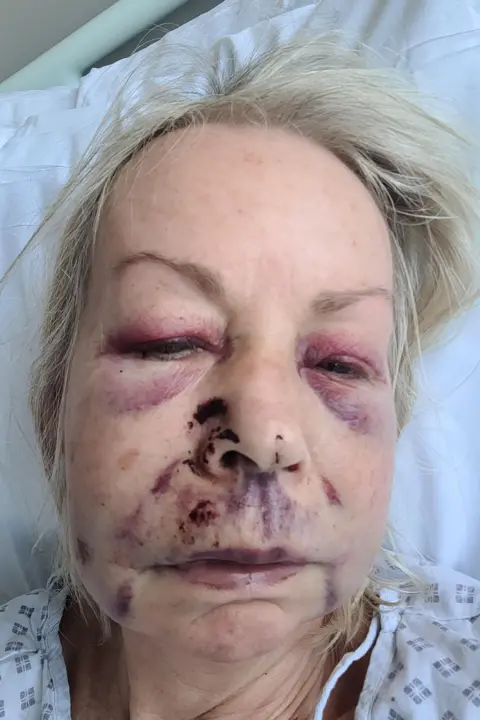 Sandy Peters A woman with a swollen face