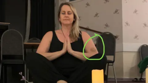 Myeloma UK A woman, with long blonde and brown hair, sitting down with her hands together in front of her body and her eyes are closed. The bruising is marked out using a green circle in the photo from Myeloma UK.
