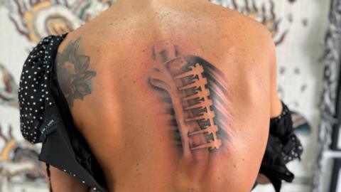 Tattoo of spinal rods and bolts
