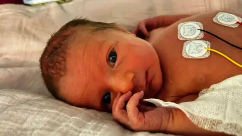 Baby Willow lying in a bed in the neonatal unit at the John Radcliffe Hospital in Oxford. She has wires on her chest and has her eyes open.