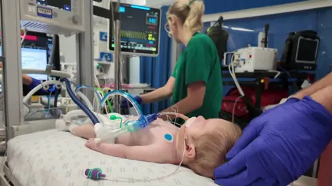 Carson in a bed in paediatric intensive care. He is lying on his back with tubes coming out of his mouth. There is a hand wearing a blue glove holding his head. A woman with a blonde pony tail wearing a green top is checking a monitor.