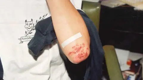 Supplied: NT Police A close up of a woman's elbow with grazes and a plaster
