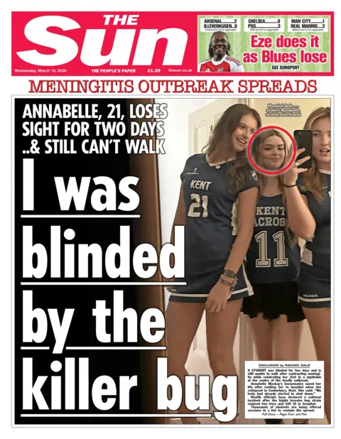 "I was blinded by the killer bug" reads the headline on the front page of the Sun.
