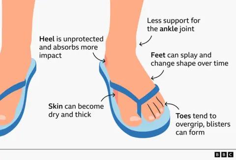 Illustration of two feet in flip flops with arrows pointing to skin, toes, ankle and heel 