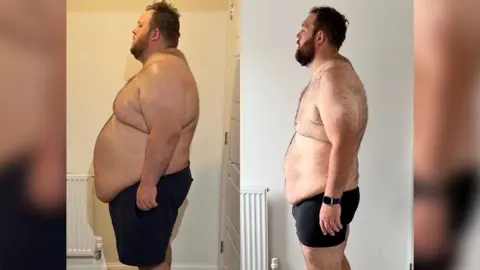A side by side comparison image of a man after losing 19.5st. He was once 38st. He is stood looking to the side, wearing just black shorts in both images. 