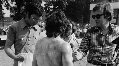 Getty Images In a black and white image, Keegan has his back turned as he gives a TV interview. His bare back has visible marks.