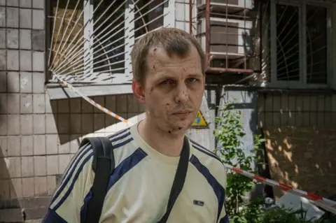 A man in a T-shirt looks on with cuts to his face in front of a building