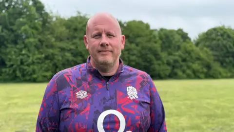 A man is standing in a field with trees behind him. He is wearing a pink and purple patterned rugby top. He is bald with a short beard.
