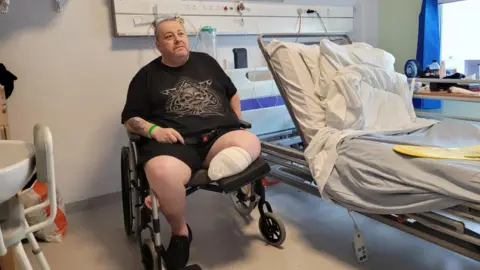 David Taylor A man is sitting in a hospital room in a wheelchair. His left leg has been amputated below the knee and has a bandage over the end.