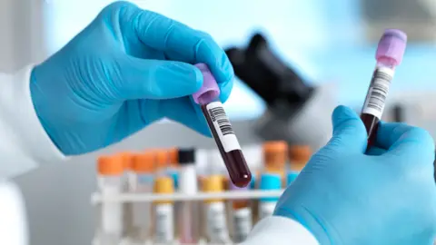 Blood vials being handled