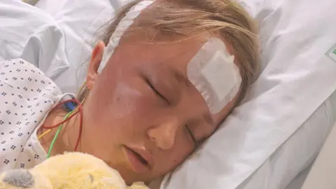 Freya Bird Freya Bird is pictured sleeping in a hospital bed while holding a light yellow fluffy teddy. There are bandages on her head and wires around her neck. One of her eyes looks swollen and her mouth is slightly open.