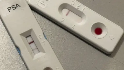 Un primer plano de dos pruebas blancas de PSA que se asemejan a las pruebas de flujo lateral utilizadas en Covid. La prueba de la izquierda muestra dos líneas que indican un resultado positivo. La prueba de la derecha muestra solo una línea que indica un resultado negativo. 