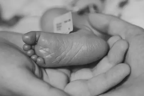 Remember My Baby A baby's foot is cradled in the hands of his parents, with his hospital tag seen attached around his ankle. The image is in black and white. 