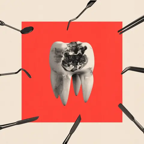 BBC A treated image of a singular tooth with an infection. It is surrounded by dentistry tools.