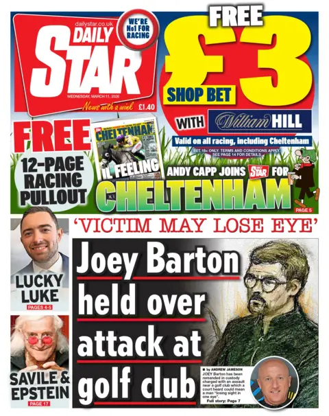 "Joey Barton held over attack at golf club," reads the headline on the front page of the Daily Star.
