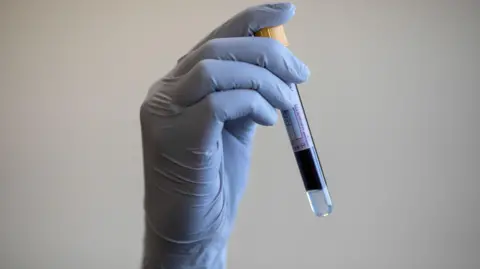 PA A person's hand -wearing a blue latex glove - holding a tube with blood sample 