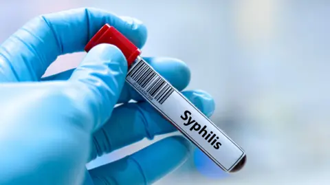 Blood sample tube for syphilis test analysis.