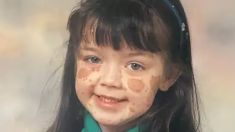 Laura Kelly A school picture of Laura Kelly. She is smiling and has long black hair and a hairband. Her birthmarks are visible. 