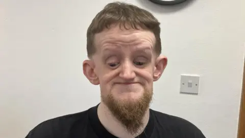 Un hombre de pelo castaño corto y barba sonríe a la cámara. Es ciego, por lo que sus ojos parecen estar mirando hacia abajo.