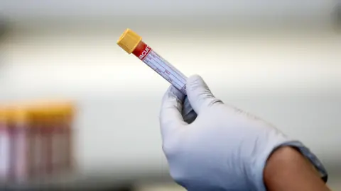 PA Media A hand in a white lab glove, holding a test tube with blood sample