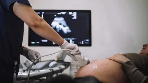 Female gynecologist doing ultrasound of pregnant woman - stock photo.