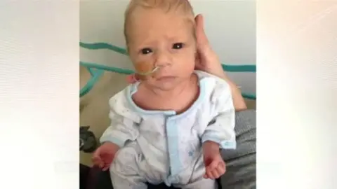 AFP A baby in a white and blue baby grow is held up to the camera. He has a nasal tube. 