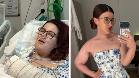 Harriet Trewhitt A side-by-side comparison showing Harriet during treatment and after. On the left, Harriet is lying in a hospital bed with medical monitoring wires attached to her chest and a heavily bandaged arm resting on the bed. On the right, Harriet is standing indoors, taking a mirror selfie with a smartphone, wearing a strapless white dress with blue floral patterns.
