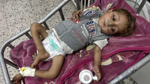 Getty Images A young child being treated at hospital in Gaza. 