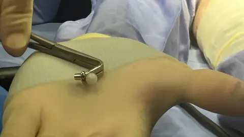 Wadsworth's left hand