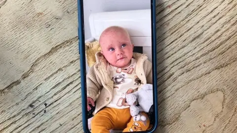BBC/Oliver Day This is an image of a smartphone on a table. On the smartphone screen is a baby girl, Autumn, with flared-up eczema on her skin.
