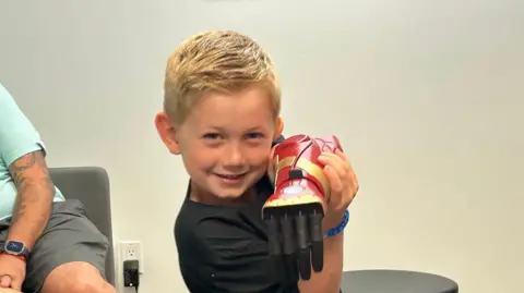 Boy showing his prosthetic arm to the camera