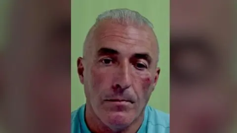 IOM Police A headshot of Adrian Larcombe, a man with slicked-back grey hair and a long face. He is wearing a light blue T-shirt and appears to have a bloodied bruise near his eye on his left cheek.