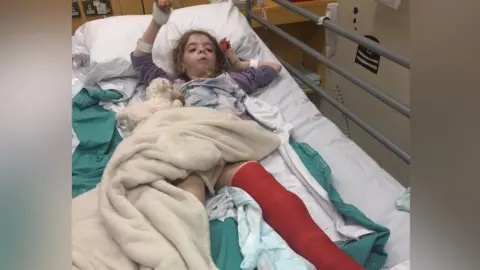 Family photo Amy lies on a hospital bed at Addenbrooke's Hospital, aged nine. She has a white fluffy toy by her side. She is wearing a purple top and her left leg is bandaged heavily with a red cast. The bed rail is up at the side. A white fluffy blanket covers her waist and upper leg.