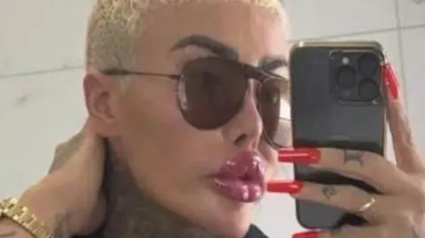 Jordan Parke is pouting in a selfie with botox filled lips, aviator shades and short bleached hair