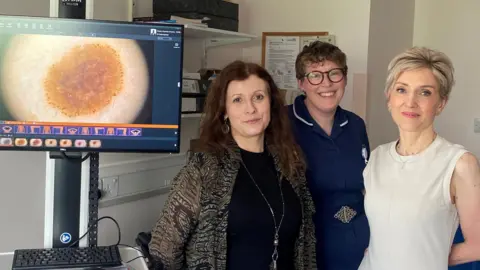 On the left is a monitor that has a zoomed in picture of a mole. On the right are three people standing looking towards the camera. They are standing in a small white room.