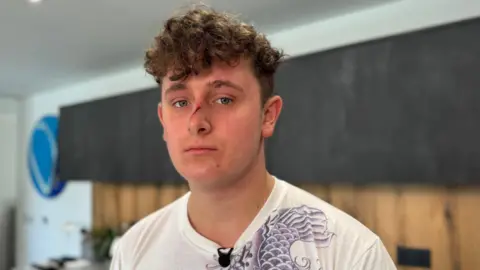Freddie Sampson has a cut on his nose. He has curly, brown hair and wears a white T-shirt.