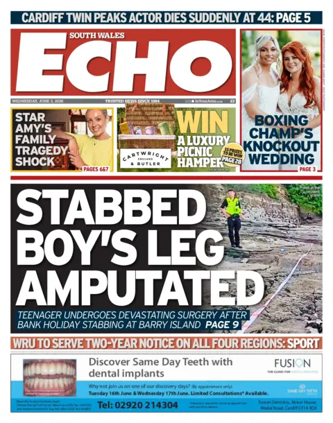 South Wales Echo South Wales Echo front page with headline stabbed boy's leg amputated. Other headlines read: Boxing champ's knockout wedding, Star Army's family tragedy shock, and WRU to serve two-year notice on all four regions. 