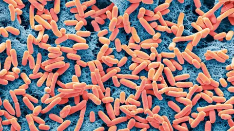 Getty Images de las docenas de bacterias E.Coli bajo un microscopio, que se asemeja a las cápsulas rojas