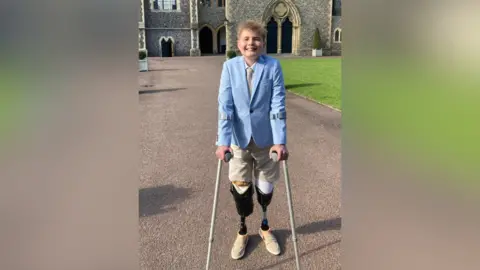 Warwick Hunter A teenager wearing a blue suit jacket and beige shorts. He also has two prosthetic legs and is holding crutches.