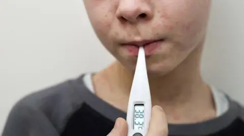 Boy with measles with thermometer in his mouth