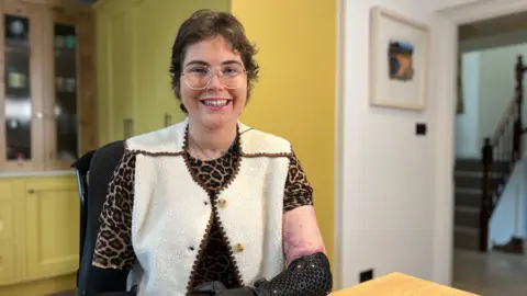 BBC Lily is sitting at a wooden table indoors, wearing a patterned top and a cream-colored vest. She has a black prosthetic arm resting on the table. Behind her is a yellow cabinet and a framed picture on the wall.
