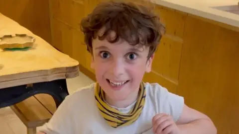 Will Ellis Will's son Odie, who has Mowatt-Wilson Syndrome, a chromosonal disorder that affects his development