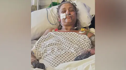 Kam Sangha Manjit in a hospital bed with monitoring equipment attached to her body, including tubes and sensors. Her arms and hands show significant injury and discolouration. Bedding and medical devices surround her. 